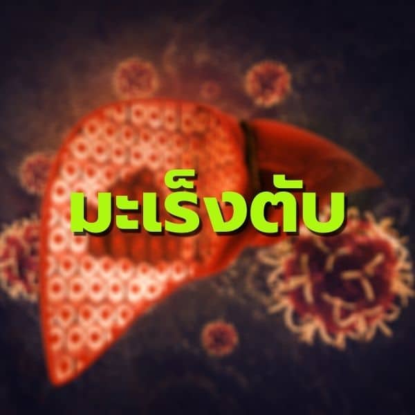 เจาะลึกพอลลิติน มะเร็งตับ