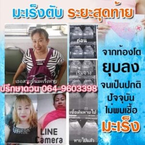 พอลลิตินมะเร็งตับ