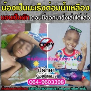 พอลลิตินมะเร็งต่อมน้ำเหลือง