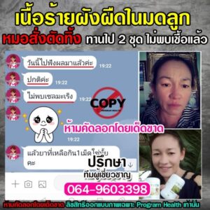 พอลลิตินรีวิว เนื้อร้ายผังผืด
