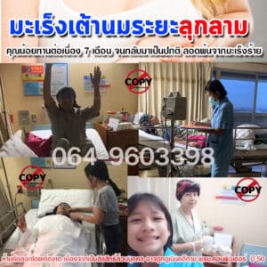 พอลลิตินรีวิวมะเร็งเต้านม