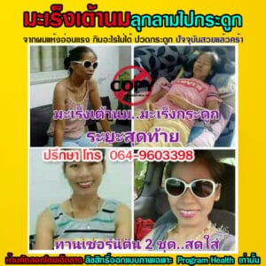 มะเร็งเต้านมลามไปกระดูก